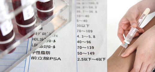 年1回の健康診断（検診、人間ドック）で早期発見！ 